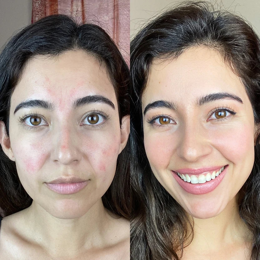 Velvet Glow Infrared Eye Therapy