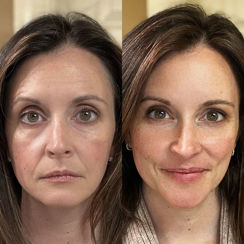 Velvet Glow Infrared Eye Therapy