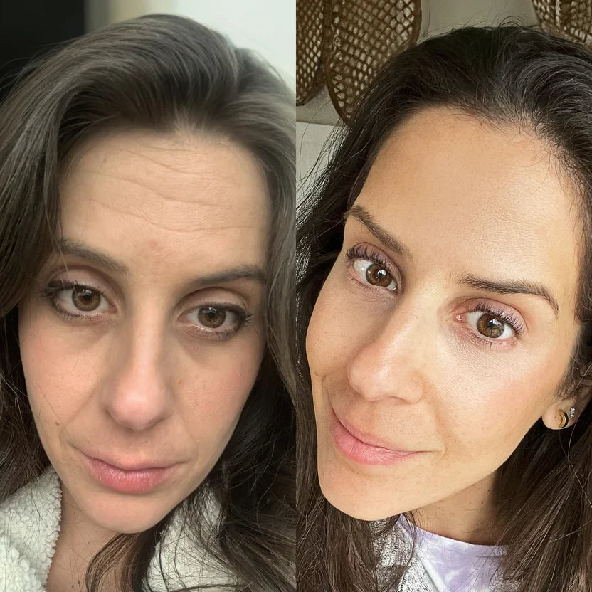 Velvet Glow Infrared Eye Therapy